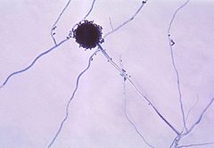 黑霉菌